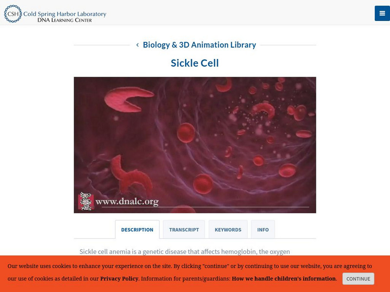 Dolan Dna Learning Center: Disease & Mutation: Sickle Cell Interactive Dolan Dna Learning Center: Disease & Mutation: Sickle Cell Interactive