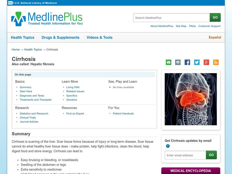 Medline Plus: Cirrhosis Links Handout Medline Plus: Cirrhosis Links Handout