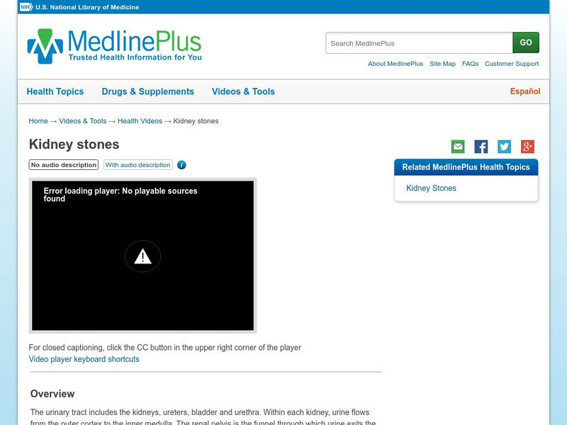 Medline Plus: Kidney Stones Handout