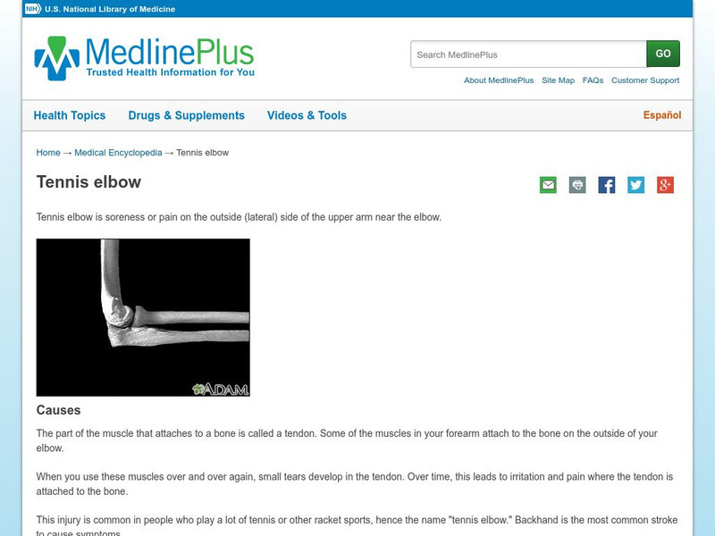 Medline Plus: Tennis Elbow Handout Medline Plus: Tennis Elbow Handout
