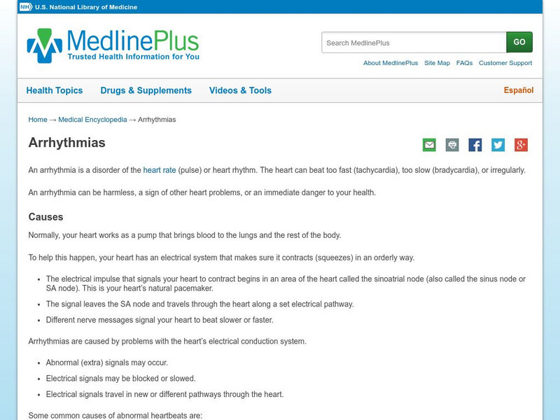 Medline Plus: Arrhythmias Handout Medline Plus: Arrhythmias Handout