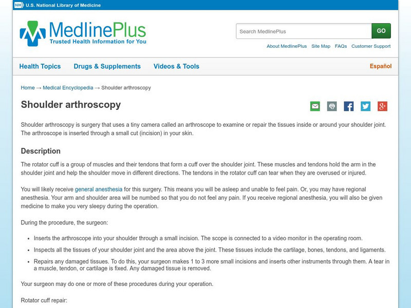 Medline Plus: Shoulder Arthroscopy Handout