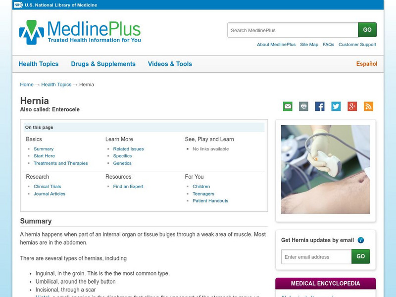 Medline Plus: Hernia Handout