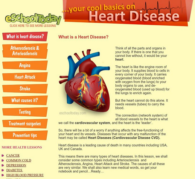 E School Today: Your Cool Basics on Heart Disease Handout E School Today: Your Cool Basics on Heart Disease Handout