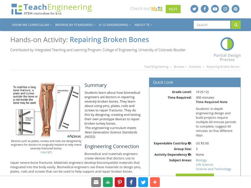 Teach Engineering: Repairing Broken Bones Activity Teach Engineering: Repairing Broken Bones Activity