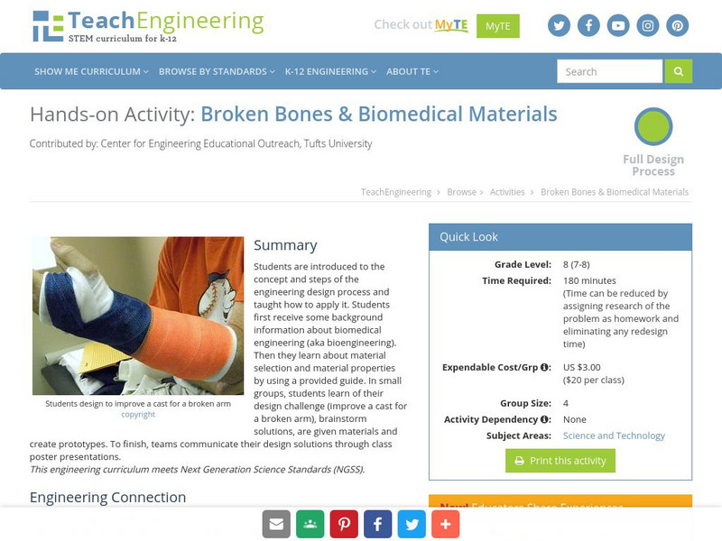 Teach Engineering: Broken Bones Activity Teach Engineering: Broken Bones Activity