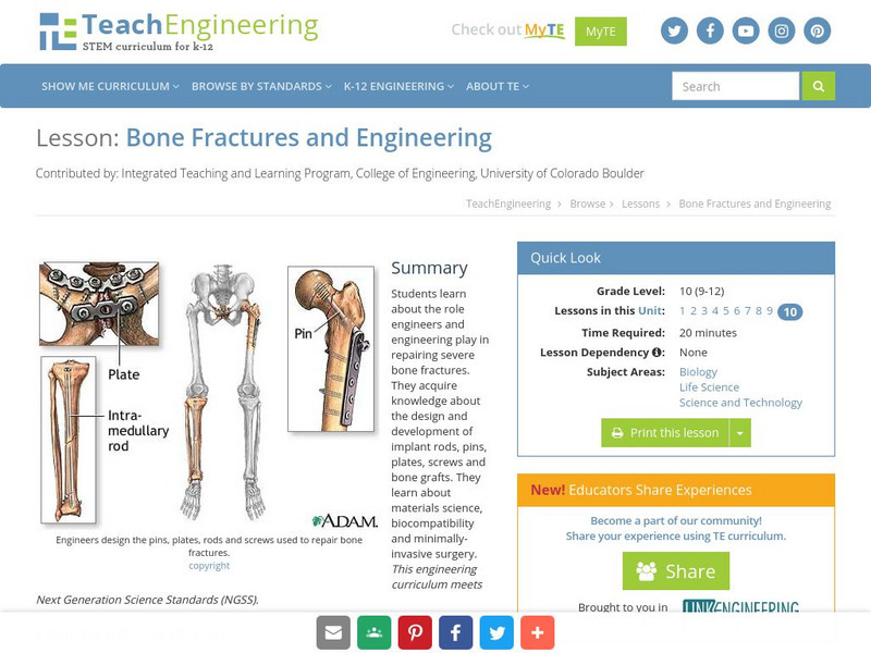 Teach Engineering: Bone Fractures and Engineering Lesson Plan Teach Engineering: Bone Fractures and Engineering Lesson Plan