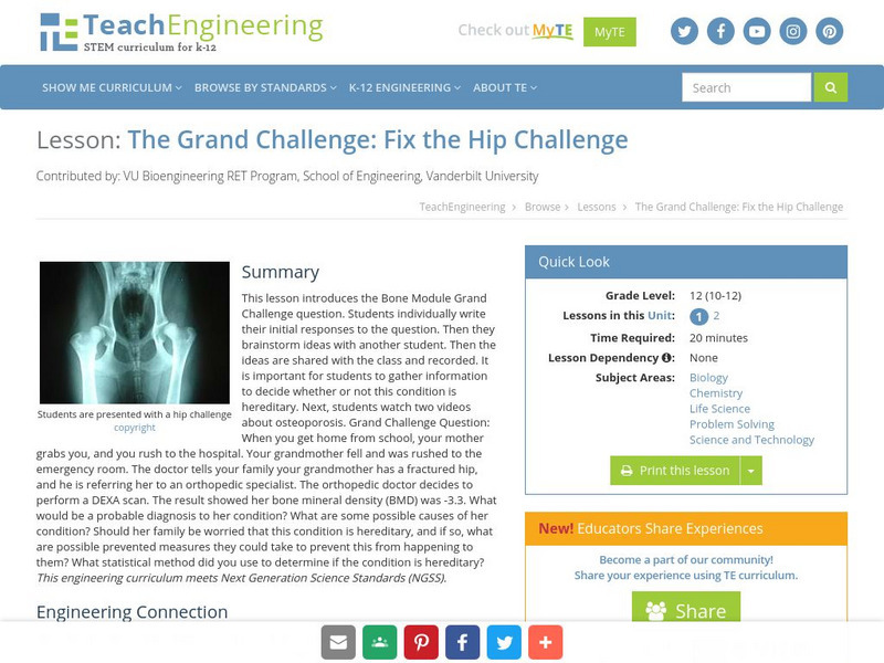 Teach Engineering: The Grand Challenge: Fix the Hip Challenge Lesson Plan Teach Engineering: The Grand Challenge: Fix the Hip Challenge Lesson Plan