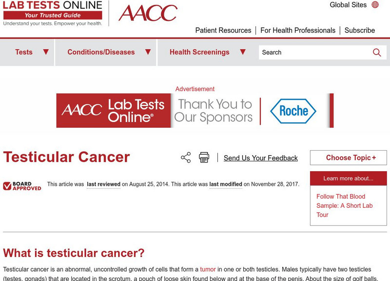 Lab Tests Online: Testicular Cancer Handout Lab Tests Online: Testicular Cancer Handout
