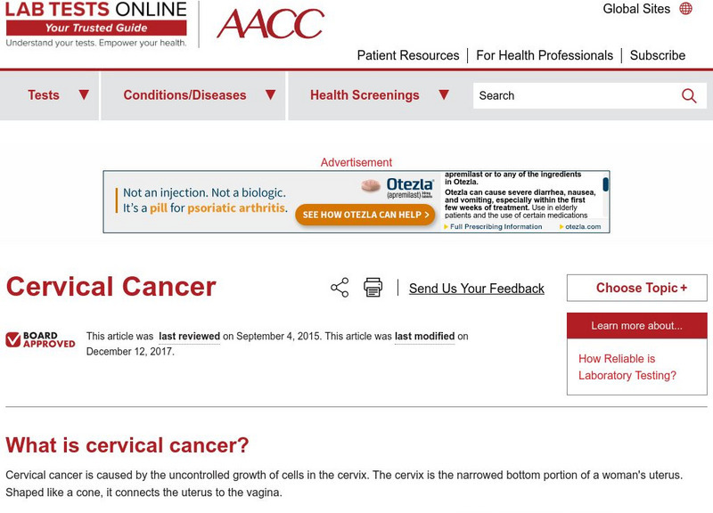 Lab Tests Online: Cervical Cancer Handout