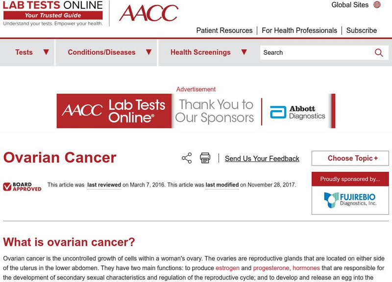 Lab Tests Online: Ovarian Cancer Handout