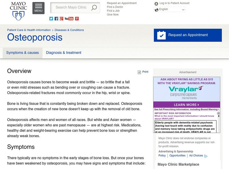 Mayo Clinic: Osteoporosis Handout