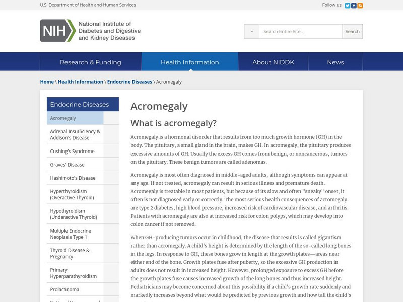 National Institute of Diabetes and Digestive and Kidney Diseases: Acromegaly Handout National Institute of Diabetes and Digestive and Kidney Diseases: Acromegaly Handout
