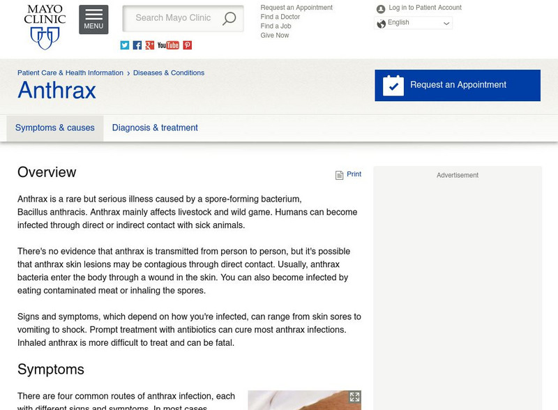 Mayo Clinic: Anthrax Overview Handout Mayo Clinic: Anthrax Overview Handout