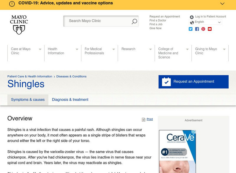 Mayo Clinic: Shingles Website
