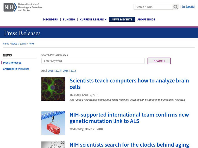 Natural Course of Muliple Sclerosis Redefined Article