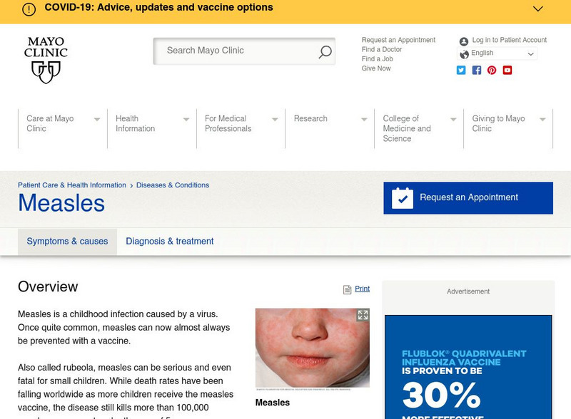 Mayo Clinic: Measles Handout