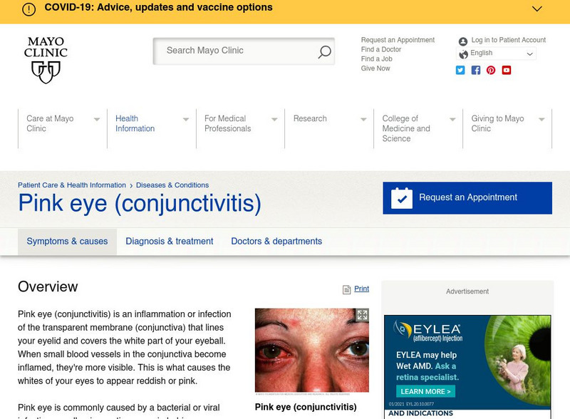 Mayo Clinic: Conjunctivitis Website Mayo Clinic: Conjunctivitis Website