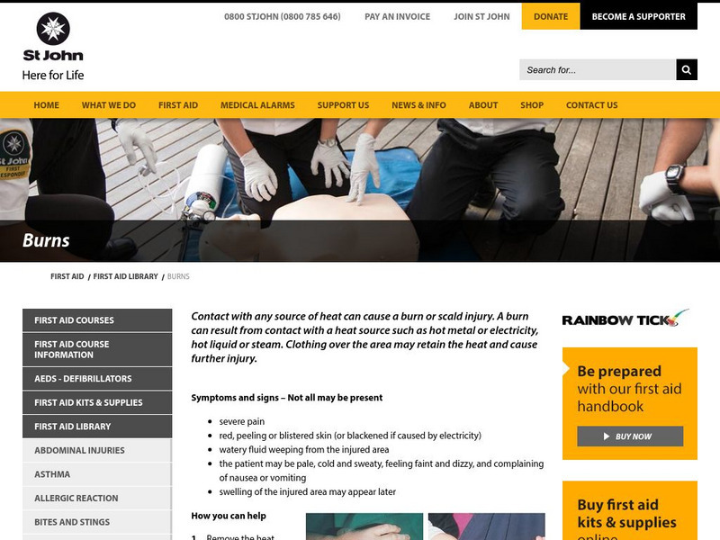 St. John: First Aid Tips for Burns Article