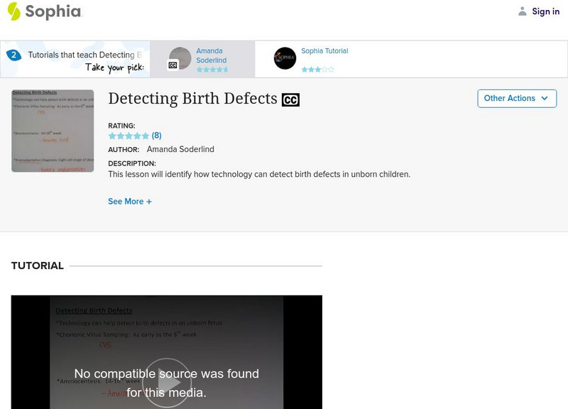 Sophia: Detecting Birth Defects Instructional Video Sophia: Detecting Birth Defects Instructional Video