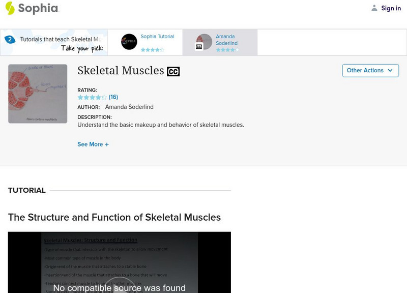Sophia: Skeletal Muscles Instructional Video Sophia: Skeletal Muscles Instructional Video