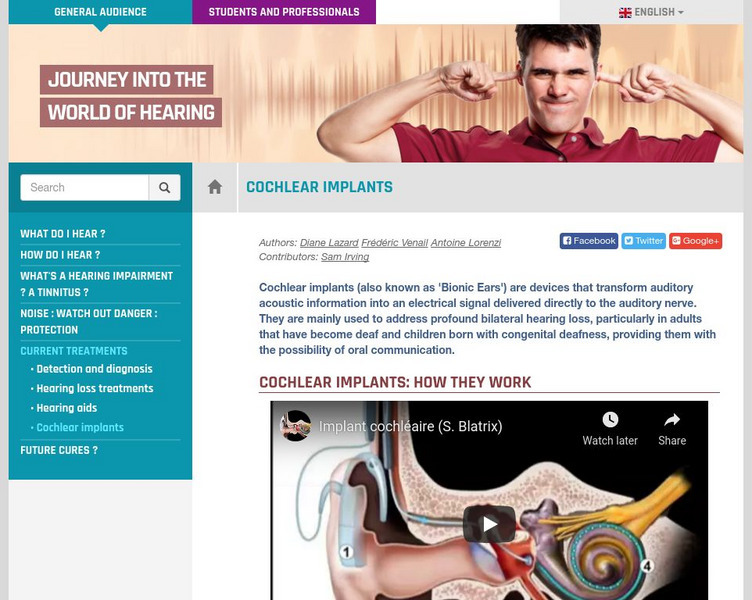 Journey Into the World of Hearing: Cochlear Implants Instructional Video