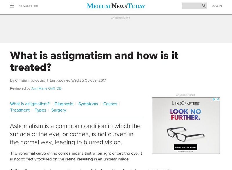 Medical News Today: Articles: Eye Health: What Is Astigmatism? Handout Medical News Today: Articles: Eye Health: What Is Astigmatism? Handout