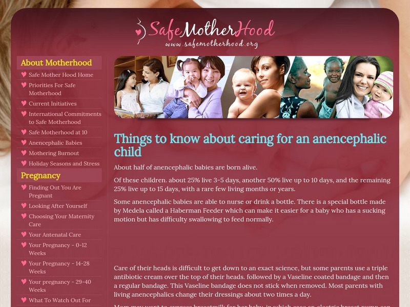 Things to Know About Caring for an Anencephalic Child Handout