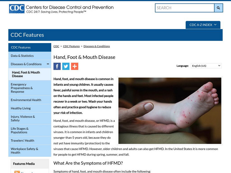 Centers for Disease Control: Hand, Foot, and Mouth Disease Handout