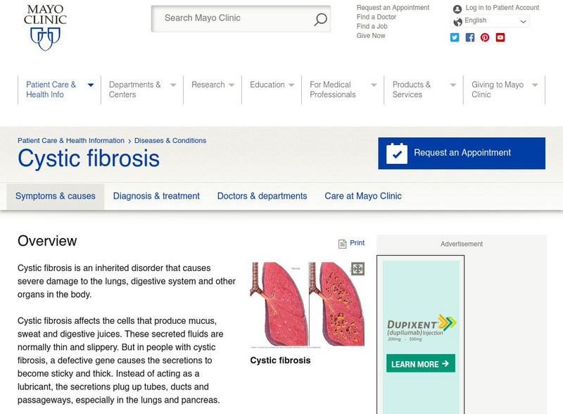 Mayo Clinic: Cystic Fibrosis Handout Mayo Clinic: Cystic Fibrosis Handout