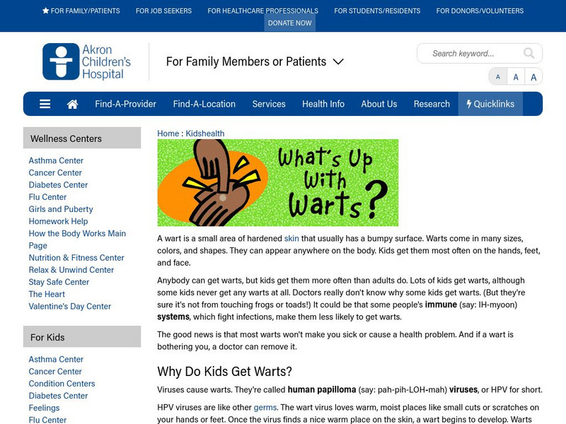 Akron Children's Hospital: Kidshealth: What's Up With Warts? Article