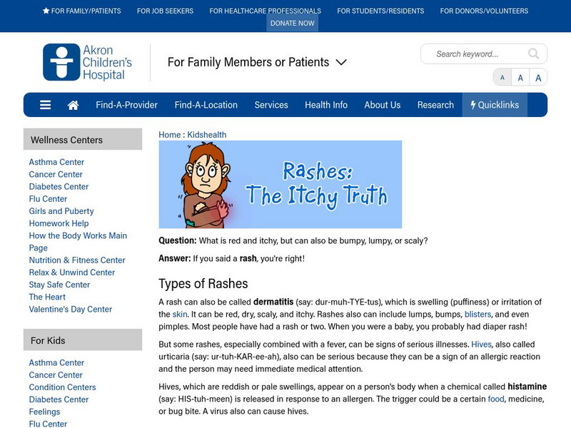 Akron Children's Hospital: Kidshealth: Rashes: The Itchy Truth Article Akron Children's Hospital: Kidshealth: Rashes: The Itchy Truth Article