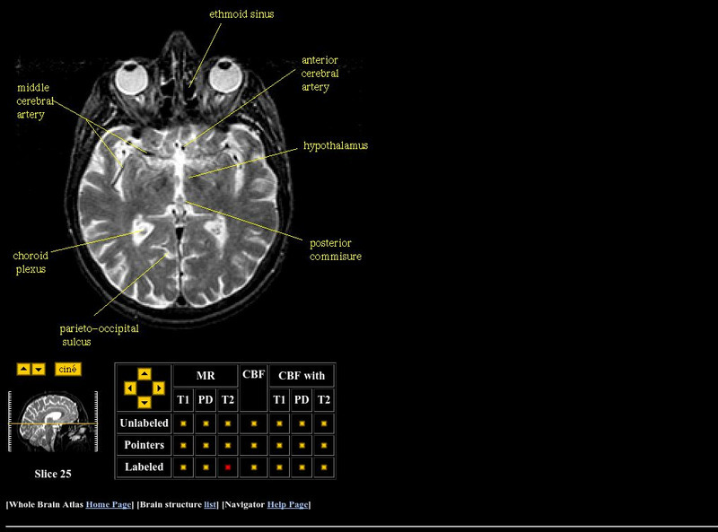 Harvard Medical School: Hypothalamus Graphic
