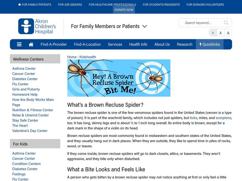 Akron Children's Hospital: Kidshealth: Hey! A Brown Recluse Spider Bit Me! Article Akron Children's Hospital: Kidshealth: Hey! A Brown Recluse Spider Bit Me! Article