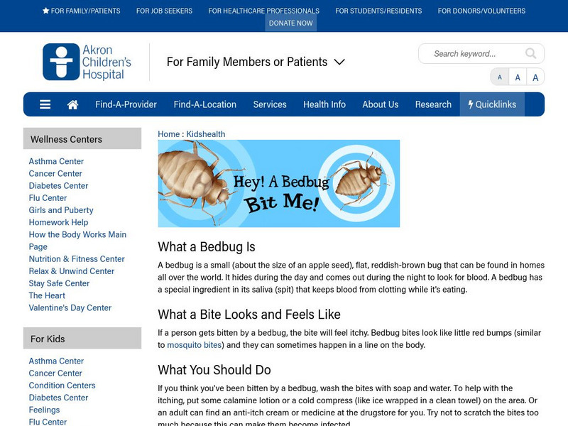 Akron Children's Hospital: Kidshealth: Hey! A Bedbug Bit Me! Article