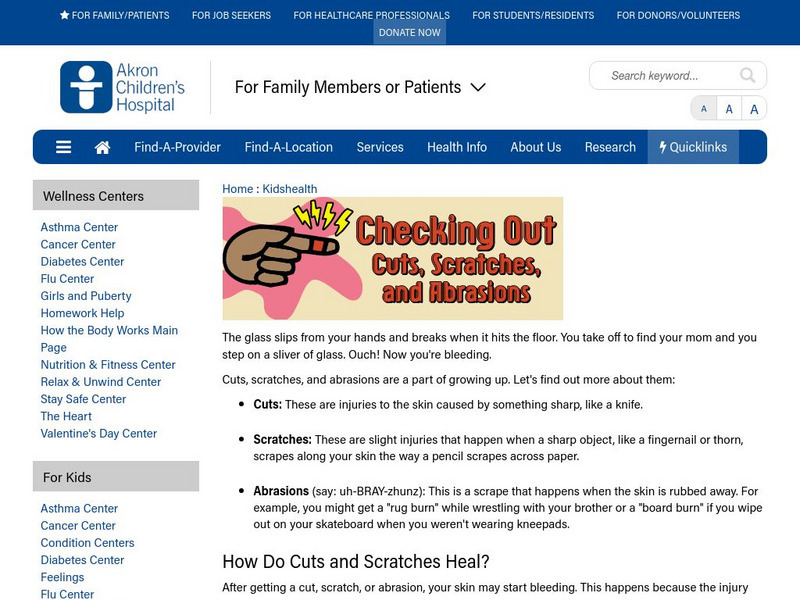 Akron Children's Hospital: Kidshealth: Cuts, Scratches, and Abrasions Article