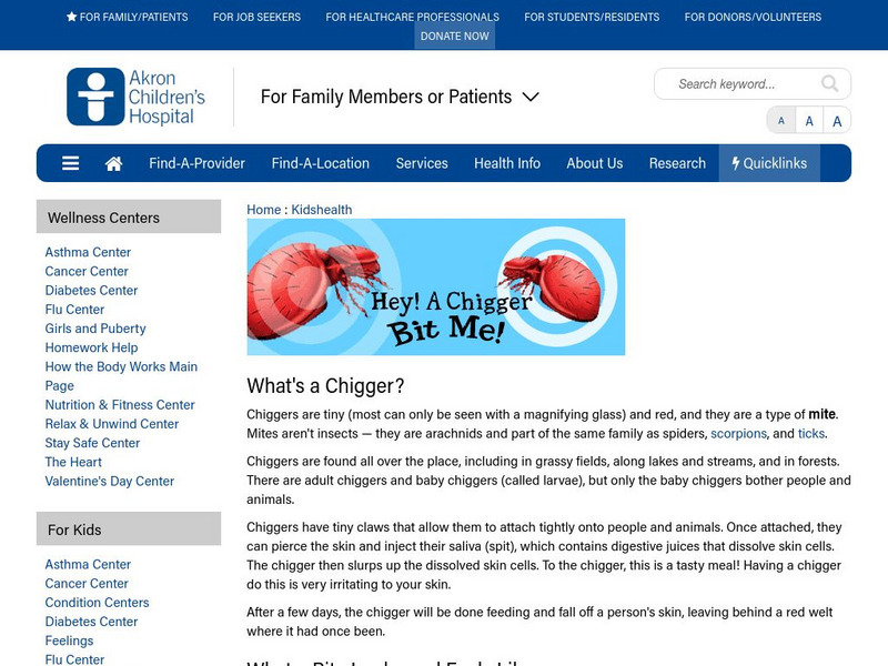 Akron Children's Hospital: Kidshealth: Hey! A Chigger Bit Me! Article Akron Children's Hospital: Kidshealth: Hey! A Chigger Bit Me! Article