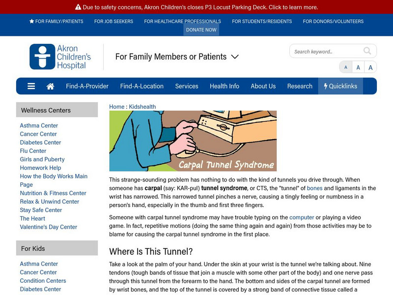 Akron Children's Hospital: Kidshealth: Carpal Tunnel Syndrome Article