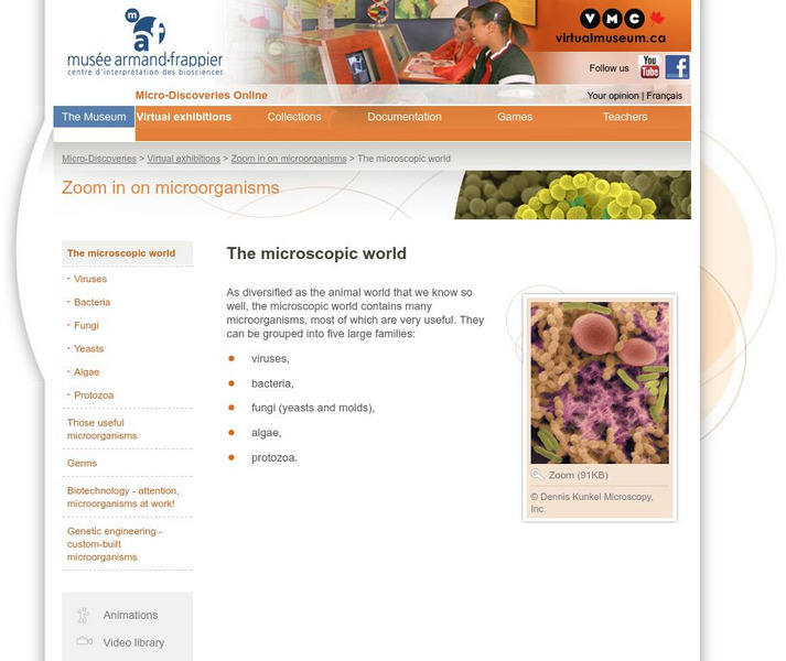 Armand Frappier Museum: Micro Discoveries Online: The Microscopic World Activity Armand Frappier Museum: Micro Discoveries Online: The Microscopic World Activity