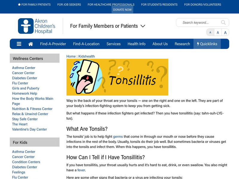 Akron Children's Hospital: Kidshealth: Tonsillitis Article