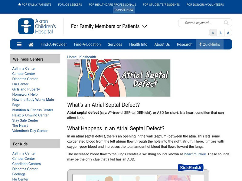 Akron Children's Hospital: Kidshealth: Atrial Septal Defect Article Akron Children's Hospital: Kidshealth: Atrial Septal Defect Article