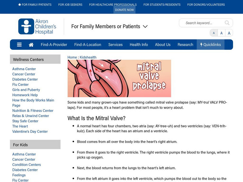 Akron Children's Hospital: Kidshealth: Mitral Valve Prolapse Article Akron Children's Hospital: Kidshealth: Mitral Valve Prolapse Article