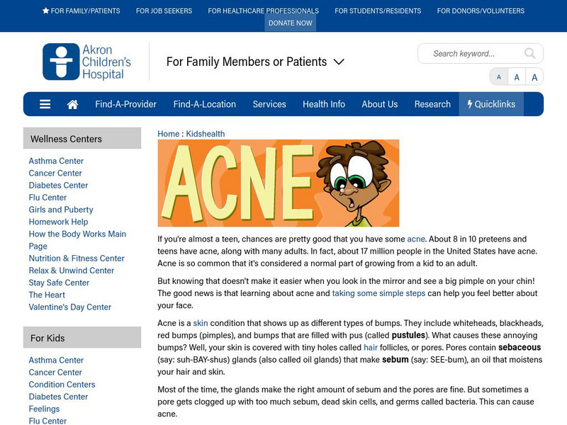 Akron Children's Hospital: Kidshealth: Acne Article