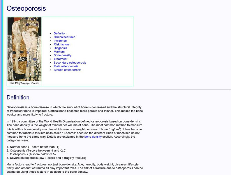 University of Washington: Osteoporosis Handout University of Washington: Osteoporosis Handout