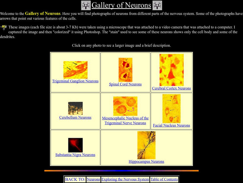 University of Washington: Gallery of Neurons Website University of Washington: Gallery of Neurons Website