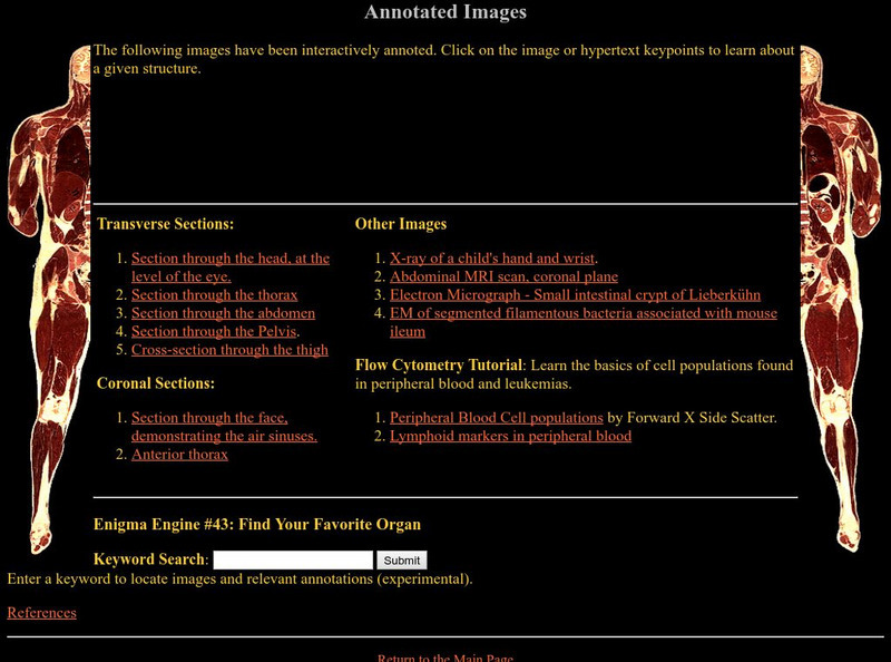 Mad Sci Network: Visible Human: Annotated References Handout Mad Sci Network: Visible Human: Annotated References Handout