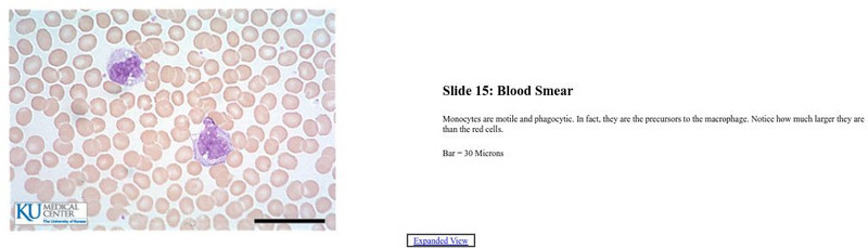 Univ. Of Kansas Medical Center: Blood Smear Graphic Univ. Of Kansas Medical Center: Blood Smear Graphic