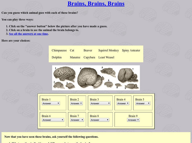 University of Washington: Brains, Brains, Brains Interactive University of Washington: Brains, Brains, Brains Interactive