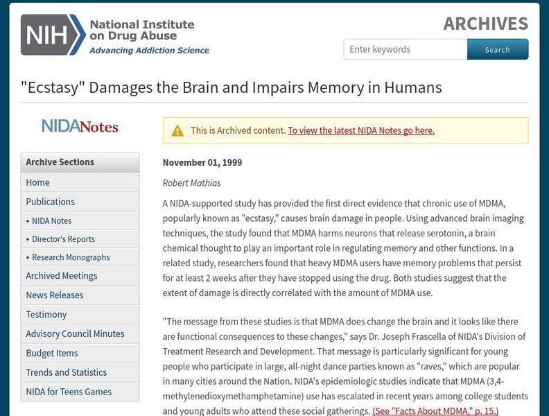 Nida: "Ecstasy" Damages the Brain Handout Nida: "Ecstasy" Damages the Brain Handout