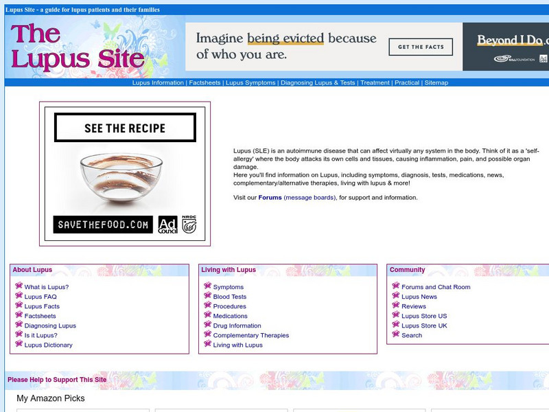 The Lupus Site Website The Lupus Site Website